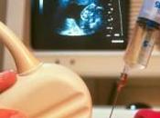 Basterà un’analisi sangue evitare l’amniocentesi
