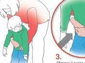 Soffocamento: come evitarlo cosa fare