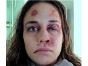 “Anno peggiore della vita”: spot choc contro violenza domestica