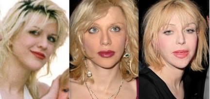 Le star prima e dopo il chirurgo: Courtney Love