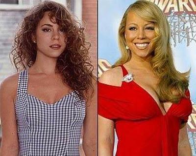 Le star prima e dopo il chirurgo: Mariah Carey