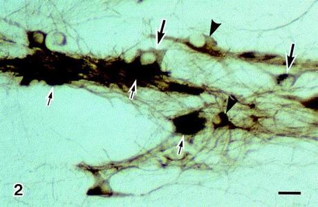 NF103 – Il Sistema Nervoso Autonomo: SNA