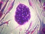 Cellule staminali: cura, legge questioni bioetiche