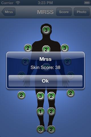 Reumatologia: ecco l’app per il calcolo del Rodnan Skin Score modificato