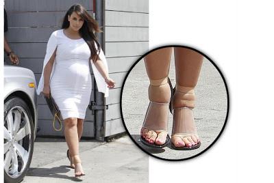Kim Kardashian ed i suoi poveri piedi gonfi torturati