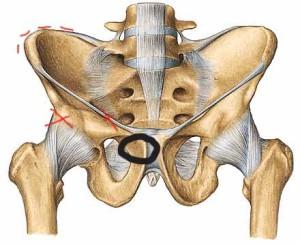 joint pain hips Pinner pain