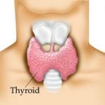 la tiroide ipotiroidismo 
