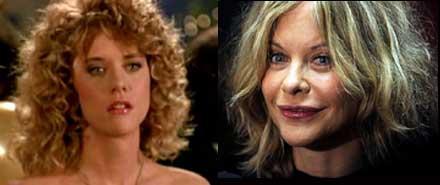 Le star prima e dopo il chirurgo: Meg Ryan