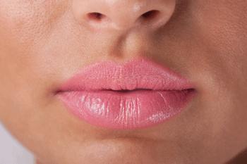 Filler labbra, un aiuto per migliorare forma e turgore
