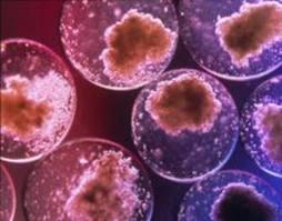 Le cellule staminali da cordone ombelicale