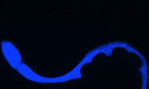 Scoperto il colore della morte: è un’onda blu fluorescente