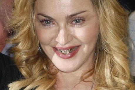 Fashion News// L'ultima trovata delle celebrities: Grillz, per un sorriso a 18 carati!