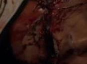 Recensioni Trash Episodio “Wrong Turn bosco fame”