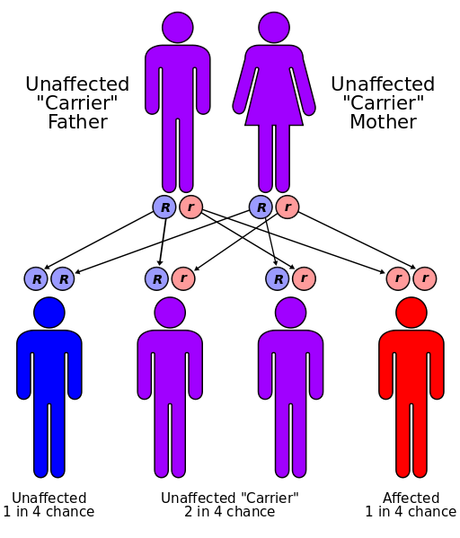 Anemia falciforme