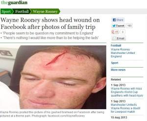 Rooney, squarcio in fronte