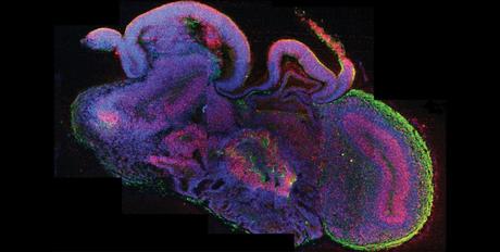 Mini-cervelli, Temperature Impossibili, DNA Alieni: 3 Recenti Meraviglie Scientifiche