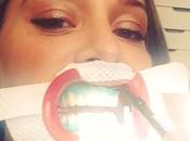 Belen Rodriguez dentista: sbiancamento prematrimoniale #paura