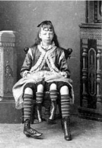 Josephine Myrtle Corbin: la donna nata con quattro gambe