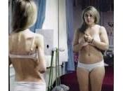 Anoressia: coinvolto anche gene. Risultato maxi studio