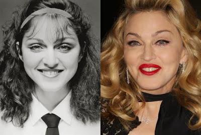 Le star prima e dopo il chirurgo: Madonna