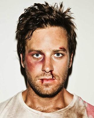 Avere Armie Hammer (come stalker)