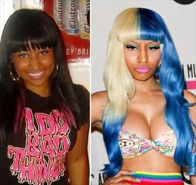 Le star prima e dopo il chirurgo: Nicki Minaj