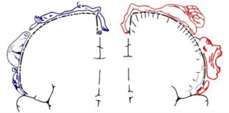 Figura 1: Omuncolo sensoriale e motorio