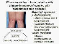 Eczema, dermatite atopica e microflora della pelle