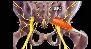 Immagini relative al rapporto anatomico tra nervo sciatico e muscolo piriforme