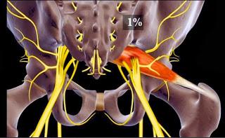 Immagini relative al rapporto anatomico tra nervo sciatico e muscolo piriforme