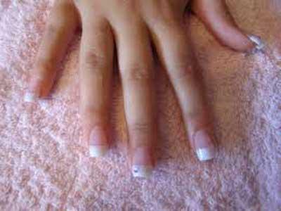 Micosi unghie, un disturbo antiestetico e spesso doloroso