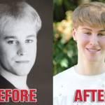Toby Sheldon: “Ho speso 100,000 dollari per assomigliare a Justin Bieber” (Foto)