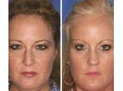 fumo invecchia pelle. foto gemelli dimostra