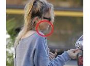 Renèe Zellweger, ritocchino viso Bridget Jones: foto