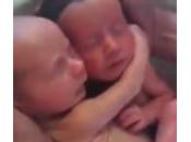 gemellini sono nati poche vogliono staccarsi (Video)