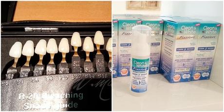 NatSmile: lo Sbiancamento Dentale Cosmetico Naturale