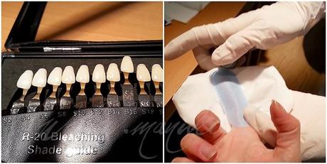 NatSmile: lo Sbiancamento Dentale Cosmetico Naturale