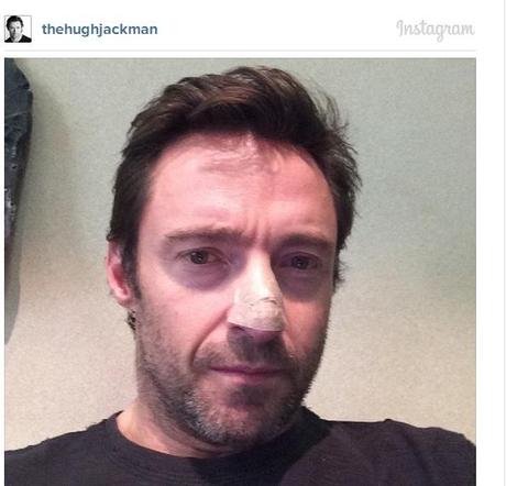 Hugh_Jackman_cancro_pelle_1