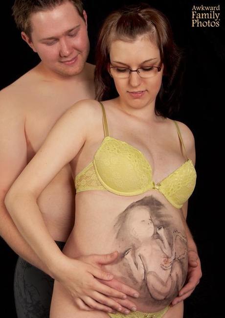  AFP - Pregnancy 6