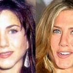 Jennifer_Aniston_prima_e_dopo_chirugia_estetica_01