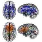 Uomini e donne, perché pensieri così diversi? La risposta nel cervello…