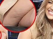 Jennifer Lopez cellulitez