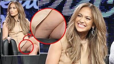 Jennifer Lopez ha la cellulitez