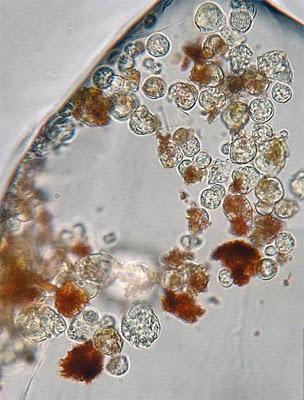 Batterio di 34.000 anni...vivo! batteri 34.000 anni vivi