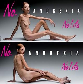 L'anoressia è una storia vera