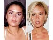 Prima dopo plastica facciale: Victoria Beckham, Halle Berry, Lindsay Lohan…