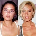 Prima e dopo la plastica facciale: Victoria Beckham, Halle Berry, Lindsay Lohan…