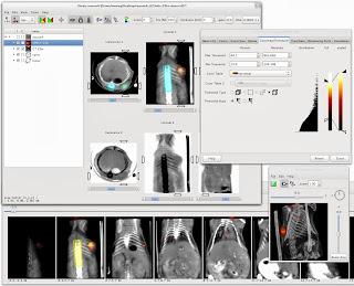 AMIDE: un analizzatore di immagini mediche Open Source