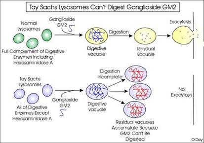 Tay Sachs: albero genealogico e calcolo delle probabilità