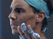 Nadal, mano pezzi